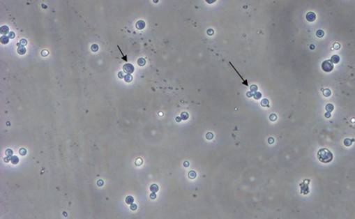 酵母双杂交技术原理、试验流程、特点以及应用