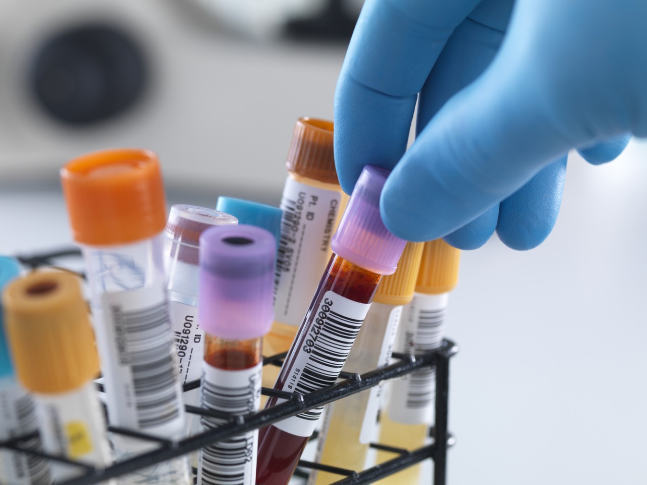 “溶出”还是“BE”，何为临床疗效“金标准”