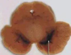 正常人：正：谥