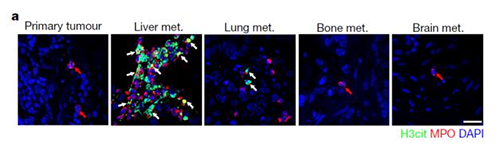转入小鼠模型得到相同的试验结果，且在转移发生前NET已在肝脏聚积。