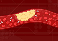 【Science速递】攻克COVID-19里程碑：已确定血凝块形成原因！