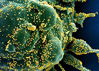 唾液检测新冠抗体新方法来了，获取结果仅需几小时！