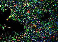 世界首创：药物将干细胞引导至受损部位，提高其愈合能力！