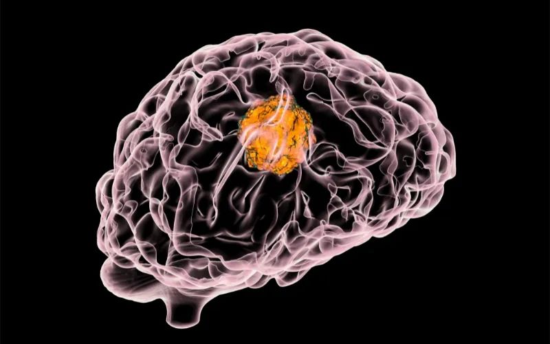 HJC黄金城平台助力 | 璧辰医药ABM-1310获美国FDA孤儿药资格认证，用于治疗携带BRAF V600突变的脑胶质母细胞瘤患者